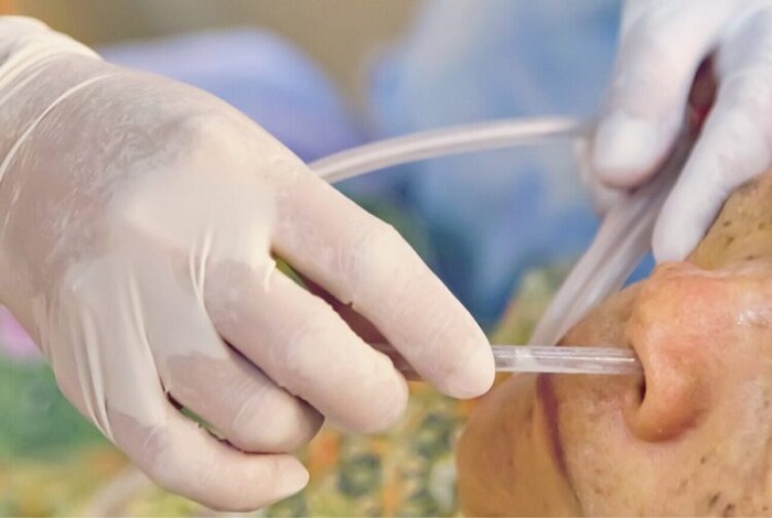 Ryles Tube Insertion At Home In Gurugram